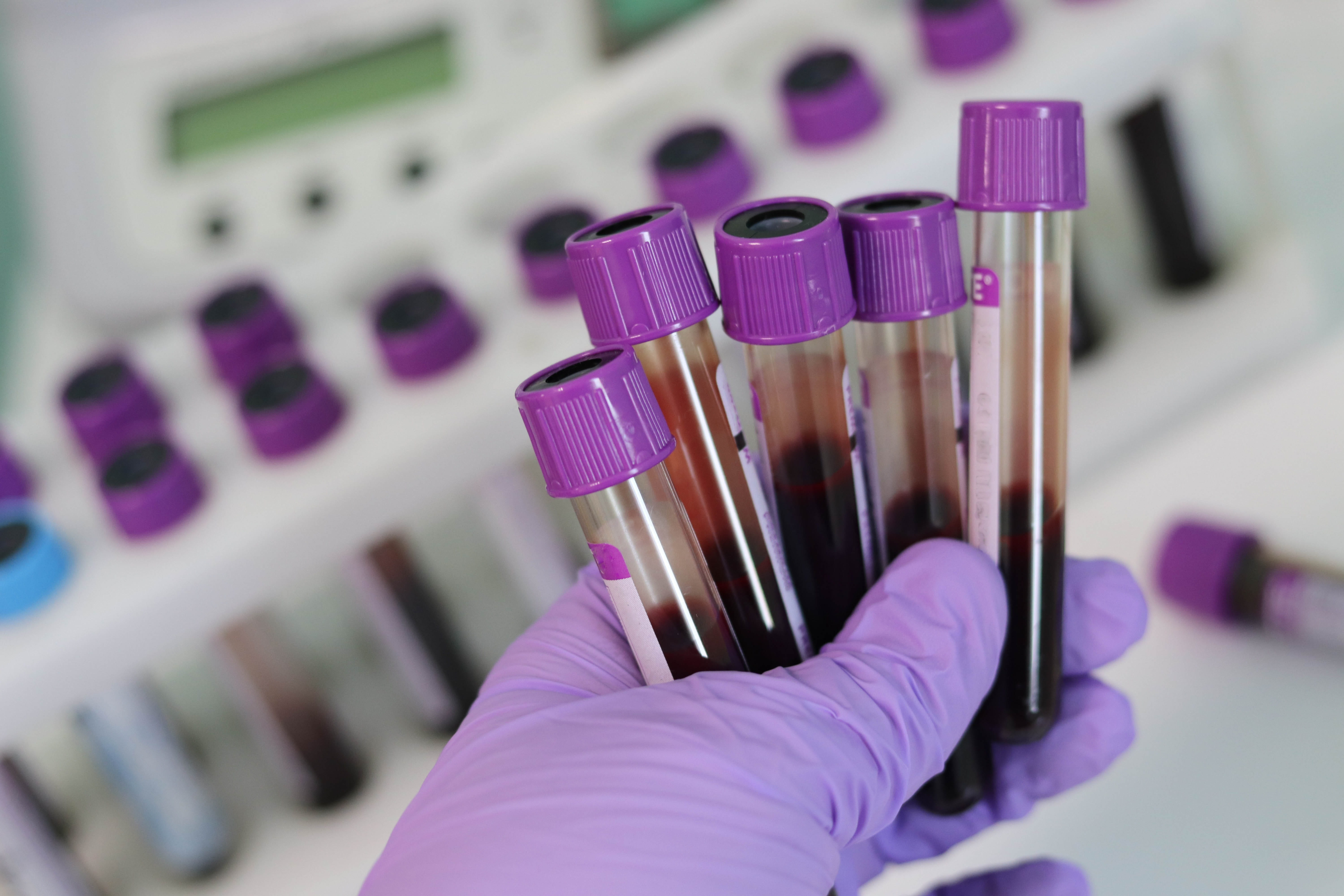Diagnostic Blood Tests at Home